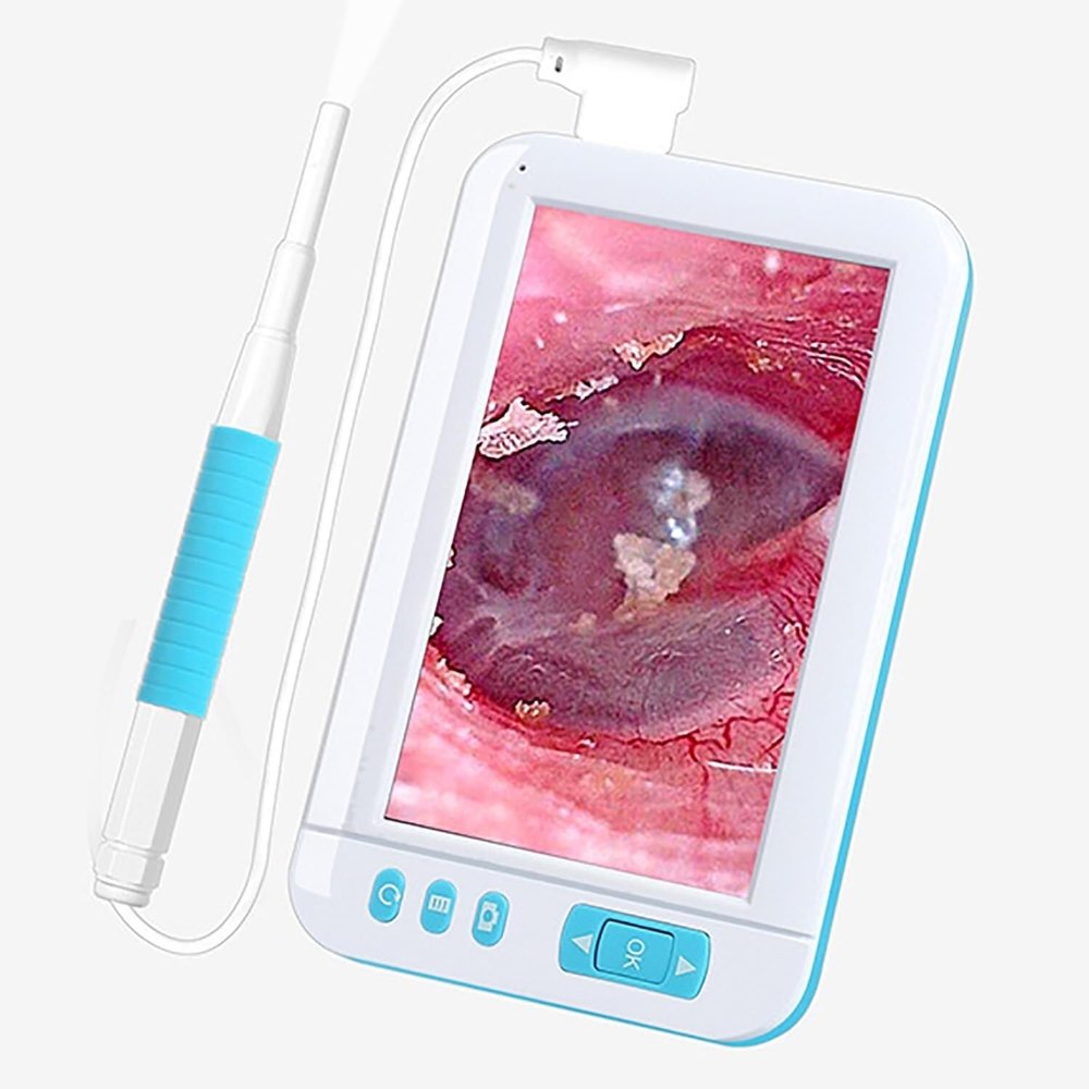 XINGLUOY Portable USB Digital Otoscope Camera, Plug and Play, HD 1080P 3.9MM Len Ear Cleaner with 4.3" IPS Screen and 6 LED Lights and Bracket, Ear Wax Removal Tool