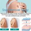 Medical Grade Scar Spray - Scar Remove Medical Grade Scar Spray,Scarremove Advanced Scar Spray,Scar Removal Spray,Surgical Scars and Stretch Marks,Acne Scars and Dark Spaot Remover (3 Pcs) view 2
