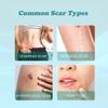 Medical Grade Scar Spray - Scar Remove Medical Grade Scar Spray,Scarremove Advanced Scar Spray,Scar Removal Spray,Surgical Scars and Stretch Marks,Acne Scars and Dark Spaot Remover (3 Pcs) view 4