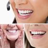 Dazzluxe Instant Veneers Fake Teeth, 4 Pair Temporary Fake Teeth for Women And Men, Nature And Comfortable Teeth Veneers To Regain Confident Smile view 4