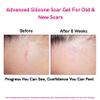 LIPOELASTIC Silicone Scar Gel 10g - Effective Scar Treatment, Scar Cream, Scar Removal Enrinched with Vitamin E Treat Old & New Scars, Surgery Scars, Acne, Wounds, C-Section Scars view 4