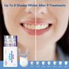 LUXSMILE Professional LED Rapid Teeth Whitening Kit, 60 Home Treatments, Zero Sensitivity, Enamel Safe, Dentist Formulated Whitener, White Smile Kit view 2
