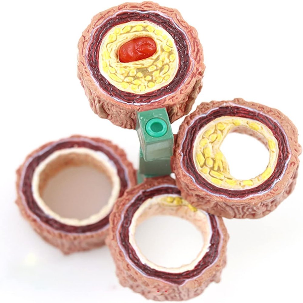 4-Piece Artery Model, Atherosclerosis Model with Plaque Build Up, Human Artery Blood Vessel Anatomy Model for Medical Science Teaching Resources.