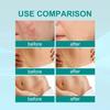 Scar Spray, Medical Grade Scar Spray, Advanced Scar Spray, for All Types of Scars (2 Pcs) view 3