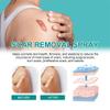 Lukcr Scar Spray, Medical Grade Scar Spray,Lukcr Medical Grade Scar Spray,Lukcr Advanced Scar Spray,Scar Remove Medical Grade Scar Spray,Advanced Scar Spray for All Types of Scars (2PC) view 4