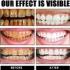 Oral Health Spray,Teeth Cleaning Spray,Clean Teeth Stains (1 Pcs) view 3