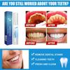 Teeth Whitening Essence Pen,Teeth Whitening Pen,Corner Teeth Whitening Pen,Indulgence Teeth Whitening,Fast and Effective Removal Tooth Stain,Reduce Yellowing (1 Pcs) view 4