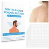 Skin Tag Remover Patches Body Mole Removal Face Neck Wart Dispel Stickers White 144PCS, Skin Tag Pads view 3