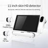 11-inch Scalp Detector, 50X/200X Skin and Hair Analyzer with Freeze Function and 4 Spectrum Detection, Detect Scalp/hair Follicles/skin Problems, Suitable for Home Beauty Salon Spa view 3