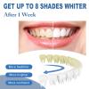 Gum Repair Gel Treatment, Teeth Whitening Pen, Instant Teeth Whitening Kit - Brighten Your Smile, Professional Dental Stain Remover, Protect Gums&Oral Care, Travel-Friendly Tooth Whitening Pen (2PC) view 2