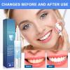 Gum Repair Gel Treatment, Teeth Whitening Pen, Instant Teeth Whitening Kit - Brighten Your Smile, Professional Dental Stain Remover, Protect Gums&Oral Care, Travel-Friendly Tooth Whitening Pen (2PC) view 3