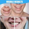2 Sets Clip on Veneers Top and Bottom Comfort Fit Flex Cosmetic Teeth, Silicone Reline Denture Set Natural White Shade, Temporary Tooth Filling Repair Kit for Men and Women Adult view 3