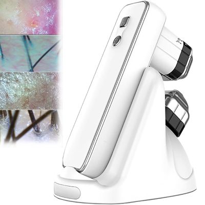 McbeAn Skin Hair Analyzer, HD Intelligent Scalp Analyzer with 50x/200x Lens, 10 Million Pixels/ 4 Spectral Detection/APP Analysis, For Use In Beauty Salons, Homes, Hair Salons