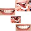 Flipped Warmth 2 Pairs False Teeth Clip in Veneers Teeth, Snap on Dentures Silicone Fake Teeth Top Bottom, Snap on Veneers Teeth White Artificial Cosmetic Fake Tooth view 2