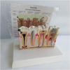 Human Tooth Model, Pathological Tooth Oral Model, Desktop Dental Manifestation with Explanation Board, Dental Teeth Decay Anatomical Model Teaching Model for Science Classroom. view 1