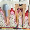 Human Tooth Model, Pathological Tooth Oral Model, Desktop Dental Manifestation with Explanation Board, Dental Teeth Decay Anatomical Model Teaching Model for Science Classroom. view 3