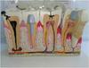 Human Tooth Model, Pathological Tooth Oral Model, Desktop Dental Manifestation with Explanation Board, Dental Teeth Decay Anatomical Model Teaching Model for Science Classroom. view 4