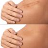 qiqiaollo Waterproof Silicone Sheets Removal Roll Fit for Surgical Scars Burns Scalds Safe Kid Adult Available Sheets and Gel for Breast Surgical Scars Silicone Sheets Clear/1504 view 2
