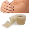 qiqiaollo Waterproof Silicone Sheets Removal Roll Fit for Surgical Scars Burns Scalds Safe Kid Adult Available Sheets and Gel for Breast Surgical Scars Silicone Sheets Clear/1504 view 4