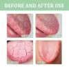 Tongue Repair Spray,Sore Tongue Relief,Mint Breath Spray,Breath Freshener Spray,Instant Dry Mouth Relief,Tongue Relief Treatment,Tongue Repair Spray for Dryness, White Coating and Bad Breath view 2