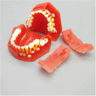 Deciduous Teeth Model - Child Teeth Teaching Model - Children's Deciduous and Permanent Teeth Alternate Model - Teeth Demonstration Model - for Study Teaching,3 to 12 Years Old (Color : 3 to 6 Years