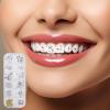 Tooth Gems Kit for Teeth - Teeth Gems Jewelry - Tooth Gem Kit, Tooth Gems Kit for Teeth, Teeth Gems, Fashionable Tooth Gems Decoration for Shining Smile view 2
