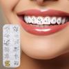 Tooth Gems Kit for Teeth - Teeth Gems Jewelry - Tooth Gem Kit, Tooth Gems Kit for Teeth, Teeth Gems, Fashionable Tooth Gems Decoration for Shining Smile view 3