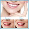 Wttfc Fake Teeth 2 Pairs Instant Veneers Dentures Smile Teeth Veneers Top And Bottom Snap on Dentures Clip in Veneers Teeth for Men Women with Bad Teeth view 4