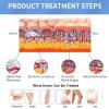 FJYAWEN ED Shockwave Therapy Device Professional Pain Relief Massager Muscle Disease Treatmentfor chronic erectile dysfunction view 3