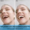 Dazzluxe 2 Pairs Temporary Veneers Teeth, Nature And Comfortable Cosmetic Fake Teeth Adjustable Snap on False Teeth for Men And Women, Regain Confident Smile view 3