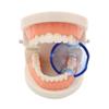 5pcs Dental Mouth Retractor Pipe Expander Mouth Opener for Posterior Teeth as Physician's Clinic Mouth Care view 2