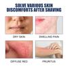 Razor Bumps Treatment for Women and Men, After Shave Solution Roll-On for Ingrown Hairs, Razor Bump Treatment for Face,Neck, Legs, and Underarm Area, Ingrown Hair SerumazorSmooth Skin(90ml) view 3