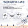 Razor Bumps Treatment for Women and Men, After Shave Solution Roll-On for Ingrown Hairs, Razor Bump Treatment for Face,Neck, Legs, and Underarm Area, Ingrown Hair SerumazorSmooth Skin(90ml) view 4