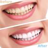 Wttfc 2 Pairs Clip in Veneers Teeth,Temporary Adjustable Clip on Veneers Top And Bottom,Smile Natural Shade Covers Braces Fake Teeth for Men Women with Bad Teeth view 2