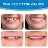 Wttfc 2 Pairs Clip in Veneers Teeth,Temporary Adjustable Clip on Veneers Top And Bottom,Smile Natural Shade Covers Braces Fake Teeth for Men Women with Bad Teeth view 3