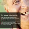 Verdant Touch Temporary Broken Teeth Repair Temporary Tooth Repair Beads, 100g Dental Filling Material for Broken or Missing Teeth view 2
