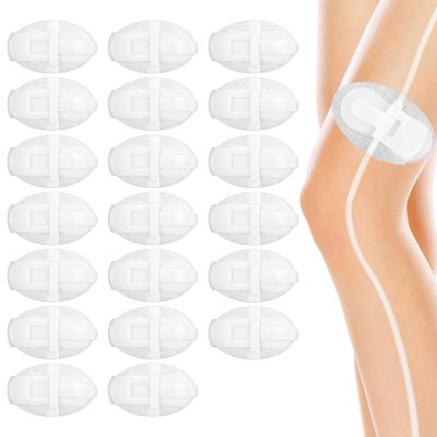 20pcs Catheter Stabilization Devices, Shelf-Adhesive Catheter Leg Straps Catheter Leg Tube Holders Urinary Leg Bag Holders Urinary Catheter Fixing Accessories for Statlock Foley