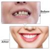 Wttfc 2 Pairs Fake Teeth,Snap on Veneers Teeth,Smile Teeth Veneers Top And Bottom Snap on Dentures,for Men Women with Bad Teeth view 3
