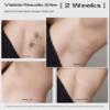 VRAIKO LYRA IPL Hair Removal Device, Laser Hair Removal for Women and Men, Sapphire Ice-Cooling Contact with Interchangeable Attachment Filters, More Skin-Friendly Long-Lasting & Painless Results view 3