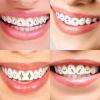 Tooth Jewelry Gems, Gem Jewelry Teeth Crystal for Women Men | Long-Lasting Shine Tooth Decoration Beginner-Friendly for Travelling, Dating, view 3