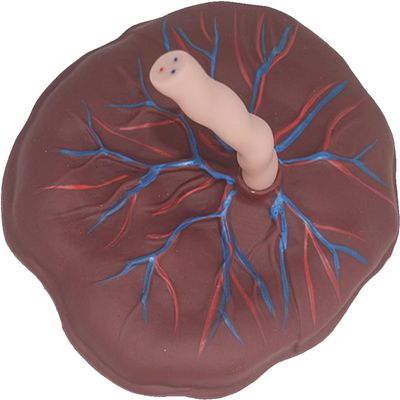 Placenta Umbilical Cord Anatomical Model, Neonatal Umbilical Cord Placenta Model with Veins Arterial Display for Gynecology Medical Educational Training Aid.