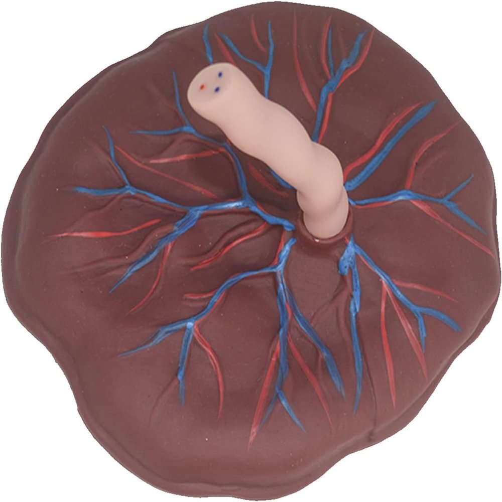 Placenta Umbilical Cord Anatomical Model, Neonatal Umbilical Cord Placenta Model with Veins Arterial Display for Gynecology Medical Educational Training Aid.