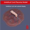 Placenta Umbilical Cord Anatomical Model, Neonatal Umbilical Cord Placenta Model with Veins Arterial Display for Gynecology Medical Educational Training Aid. view 2