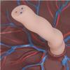 Placenta Umbilical Cord Anatomical Model, Neonatal Umbilical Cord Placenta Model with Veins Arterial Display for Gynecology Medical Educational Training Aid. view 3