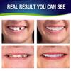 Flipped Warmth 2 Pairs False Teeth, Veneers Teeth Temporary Denture Snap in Teeth Confidence Smile Dentures False Teeth Veneers Top And Bottom for Men And Women view 4