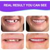 Flipped Warmth 2 Pairs Veneers Teeth Fake Teeth, Snap on Veneers Teeth, Veneers Snap in Teeth, Clip on Veneers Top and Bottom Perfect Smile Confidence with Box view 4