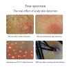 11 inch UV Skin Analyzer Professional Scalp Detector Hair Follicles Oil Moisture Tester Facial Skin Hair Analyzer Beauty Appliance view 4