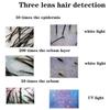 50X /200X Skin Hair Scalp Detector, Skin Hair Analyzer, Skin Health Analyzer Hair Follicle Detector Skin Care Instrument, Hair Analyser Machine Detection for Home Salon view 2