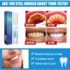 Berry Bountiful Teeth Whitening,Berry Bountiful Teeth Whitening Essence,Teeth Whitening Pen,Teeth Whitening Gel,Gum Shield Therapy Gel,Fast and Effective Removal Tooth Stain Removal (3 Pcs) view 4