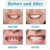 Wttfc Fake Tooth,2 Pairs Clip in Veneers Teeth Veneers Teeth Top And Bottom Set,Teeth Covers,Snap on Dentures Silicone Fake Teeth,Adjustable Snap on Dentures Covers Set for Men And Women view 4